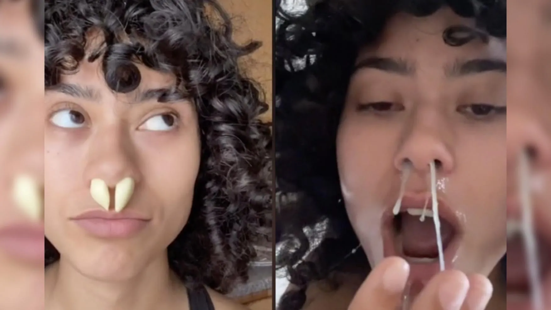 Ponerse un ajo en la nariz para respirar mejor, la nueva moda de Tik Tok